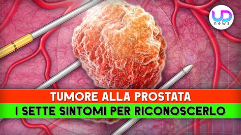 rostata|tumore prostata .